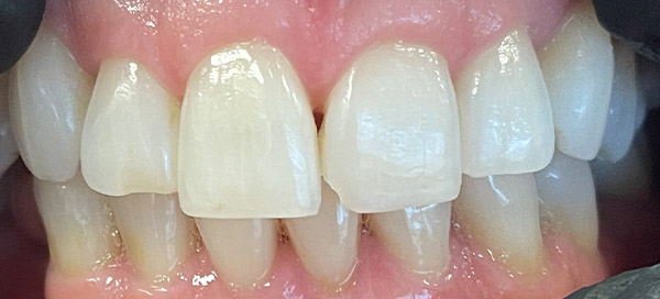 Before image