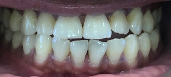 Before image