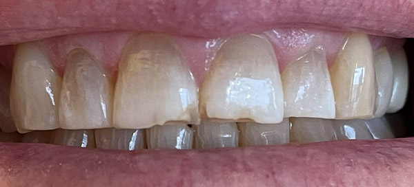 Before image