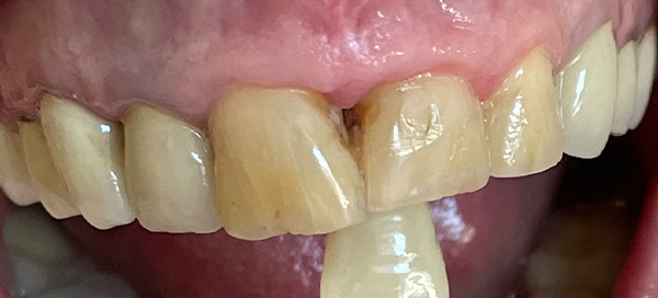 Before image