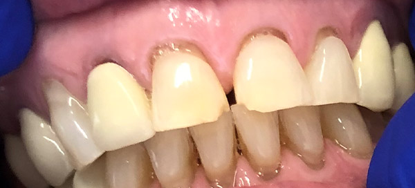 Before image